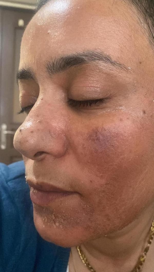 Sıla Yıldız Beauty - 9. Fotoğraf Sıla Yıldız Beauty - 9. Fotoğraf