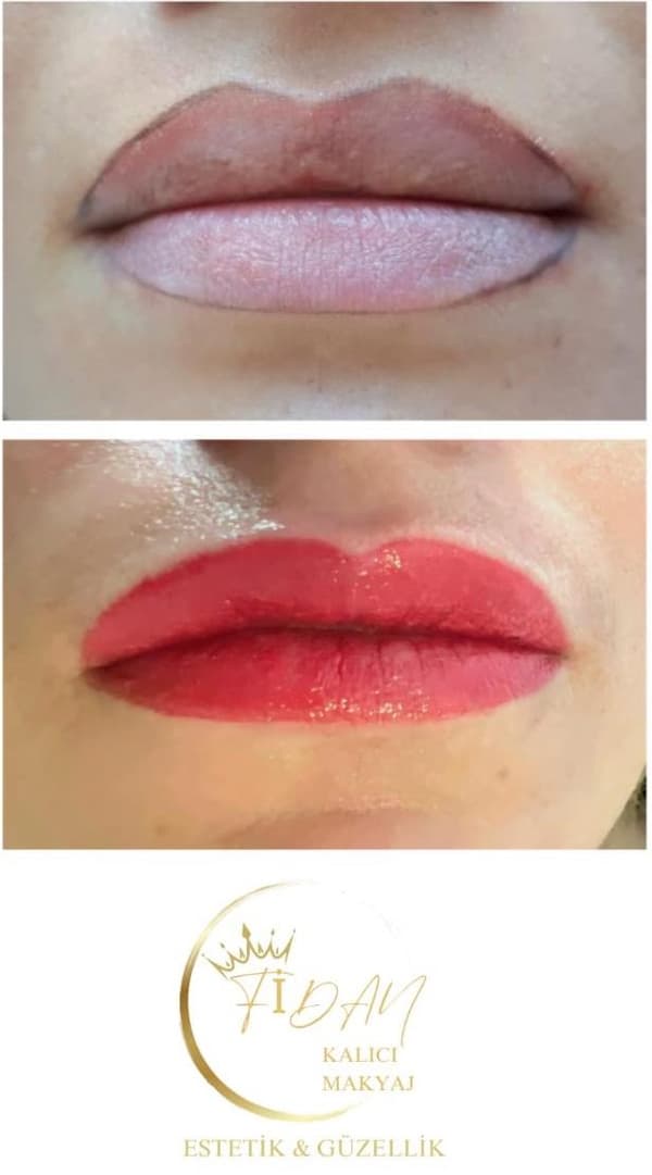 Fidan Kalıcı Makyaj Estetik Güzellik - 11. Fotoğraf Fidan Kalıcı Makyaj Estetik Güzellik - 11. Fotoğraf
