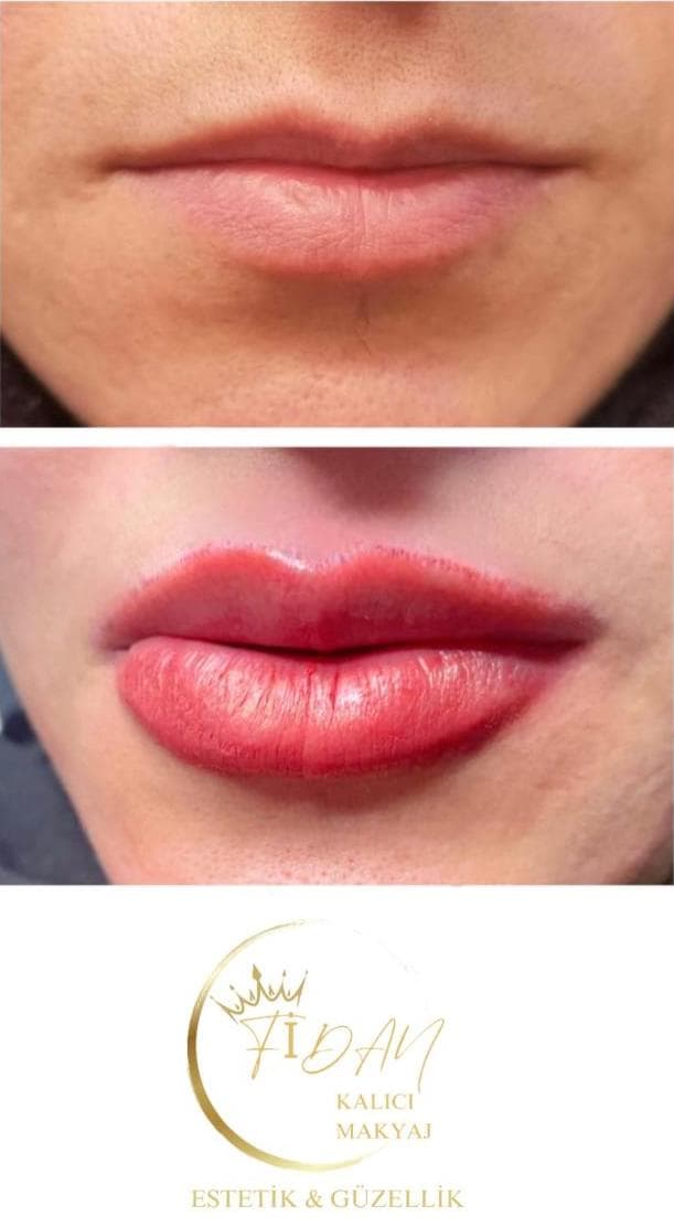 Fidan Kalıcı Makyaj Estetik Güzellik - 5. Fotoğraf