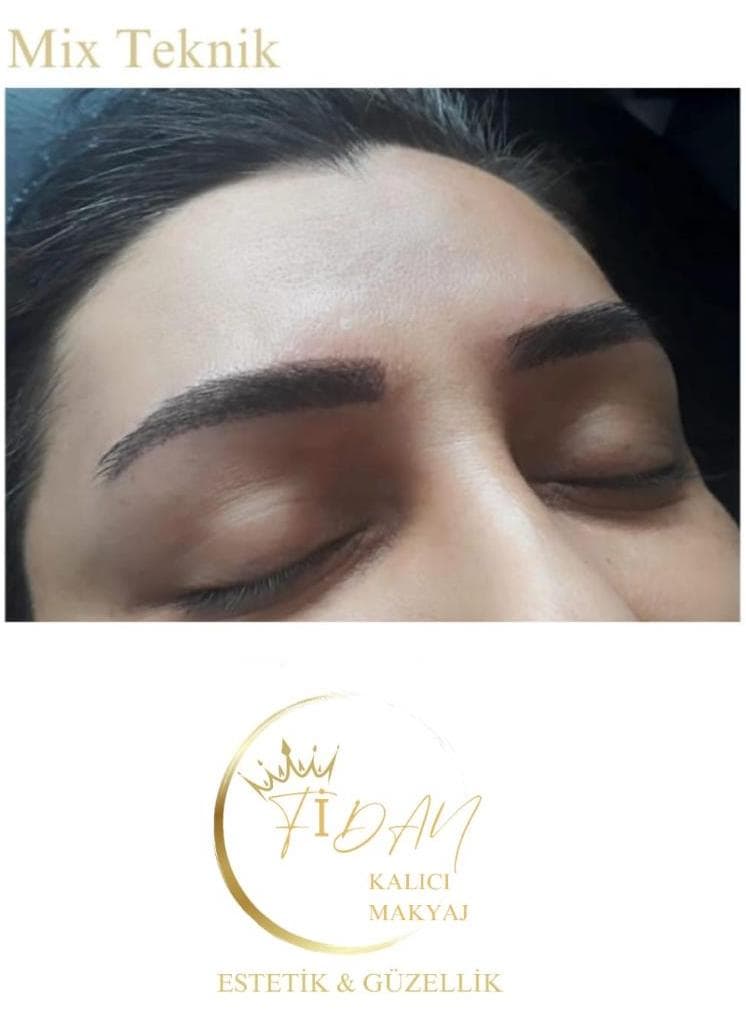 Fidan Kalıcı Makyaj Estetik Güzellik - Altındağ Ameliyatsız Yüz Germe - 4. Fotoğraf