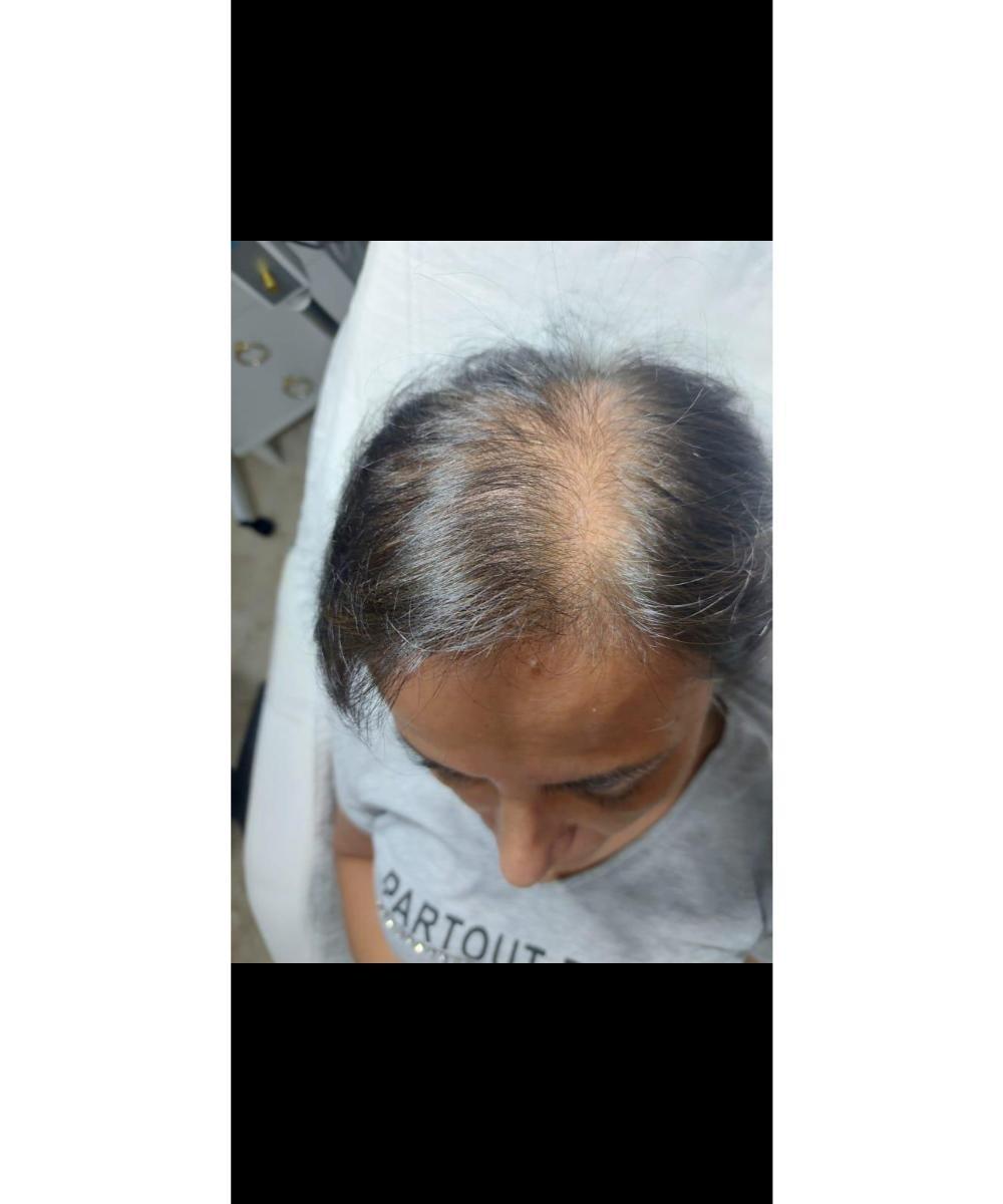 Flora Güzellik - Dikimevi Cilt Yenileme - 2. Fotoğraf