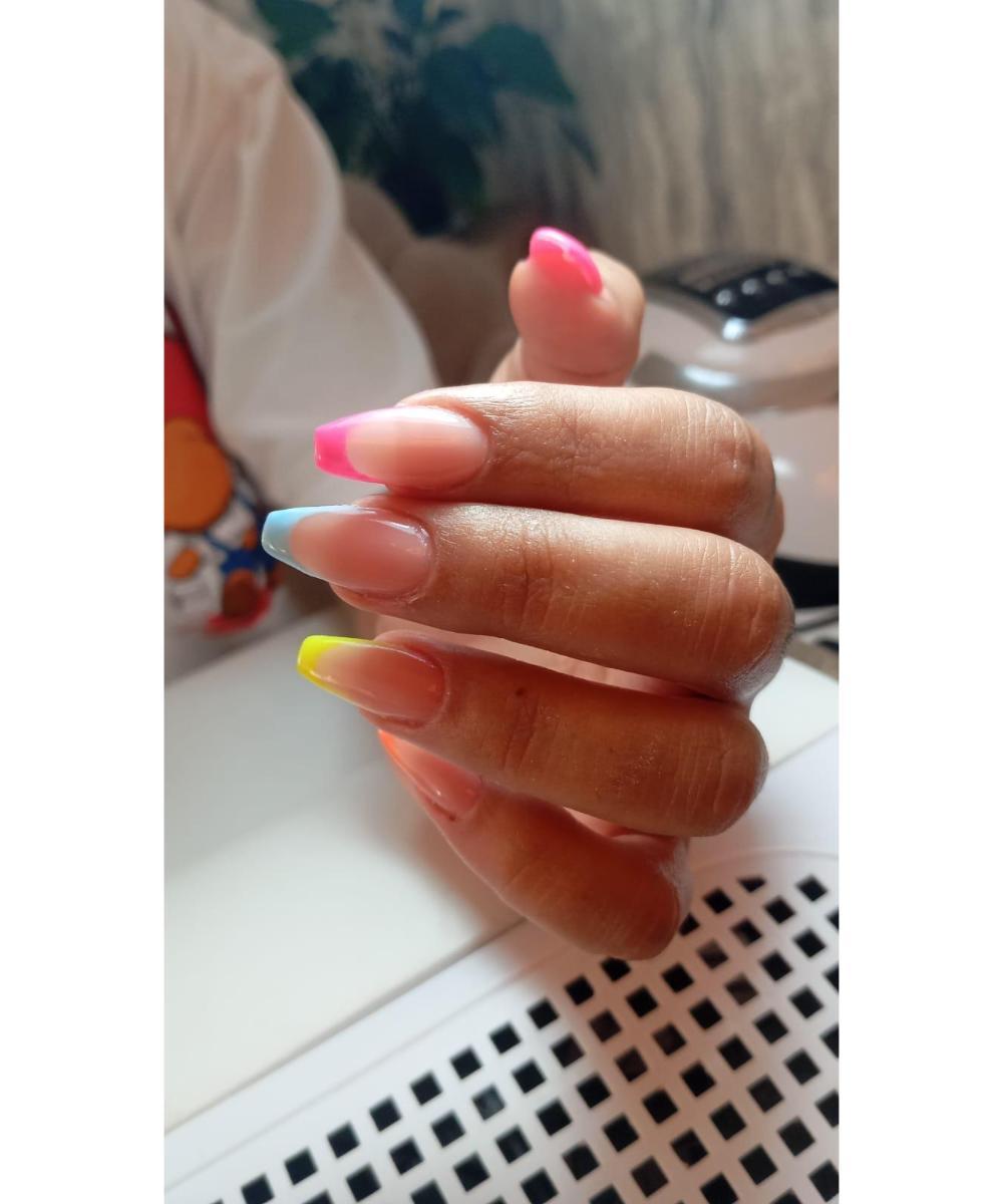 Flora Güzellik - Dikimevi Cilt Yenileme - 4. Fotoğraf