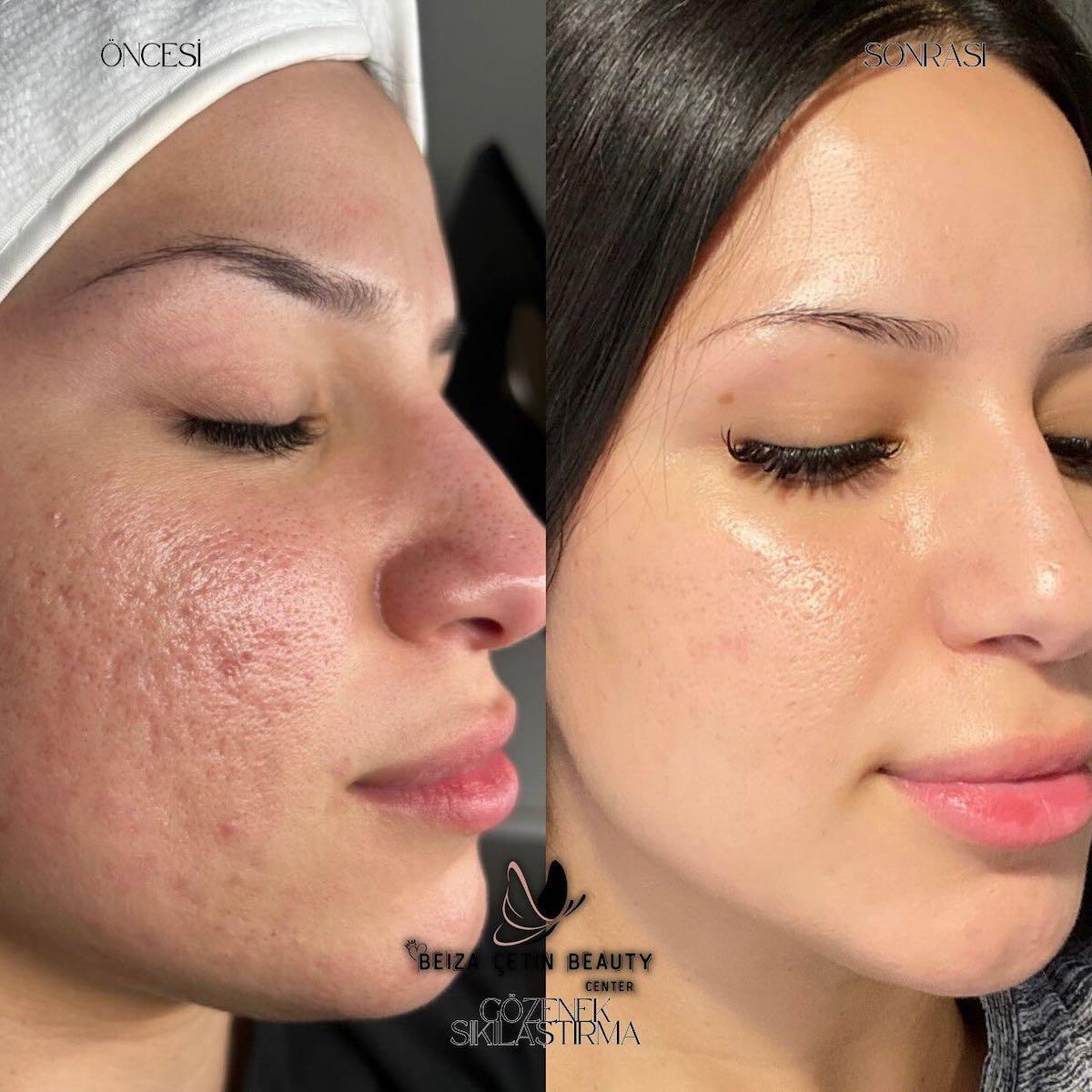 Beiza Çetin Beauty Center - Oran  Mekanları - 2. Fotoğraf