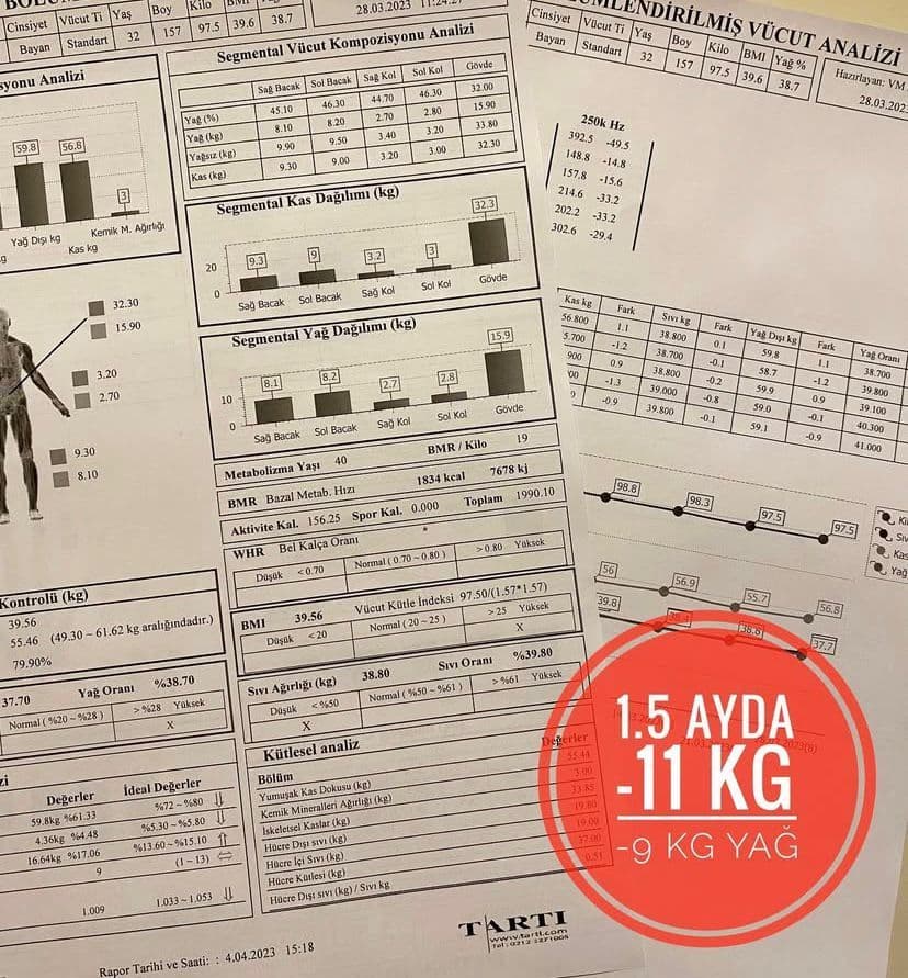 Uzman Dyt. Cansu Özçelik - Cevizlidere Diyetisyen - 2. Fotoğraf