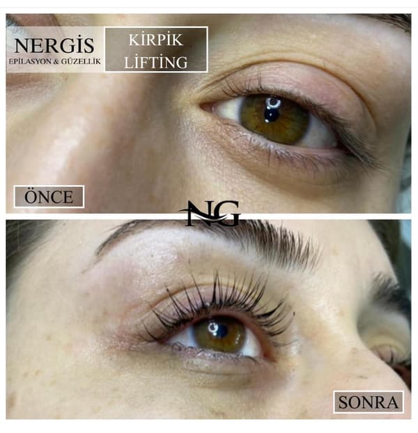 Nergis Epilasyon ve Güzellik - 10. Fotoğraf Nergis Epilasyon ve Güzellik - 10. Fotoğraf