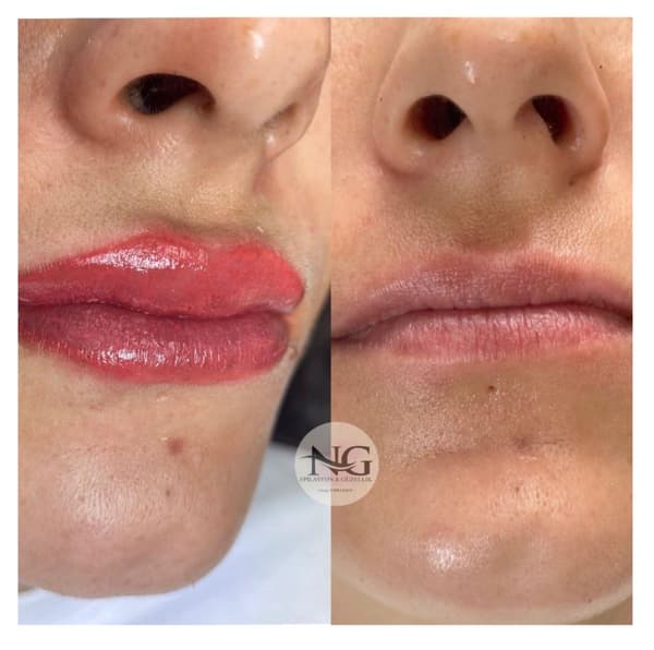 Nergis Epilasyon ve Güzellik - 4. Fotoğraf Nergis Epilasyon ve Güzellik - 4. Fotoğraf