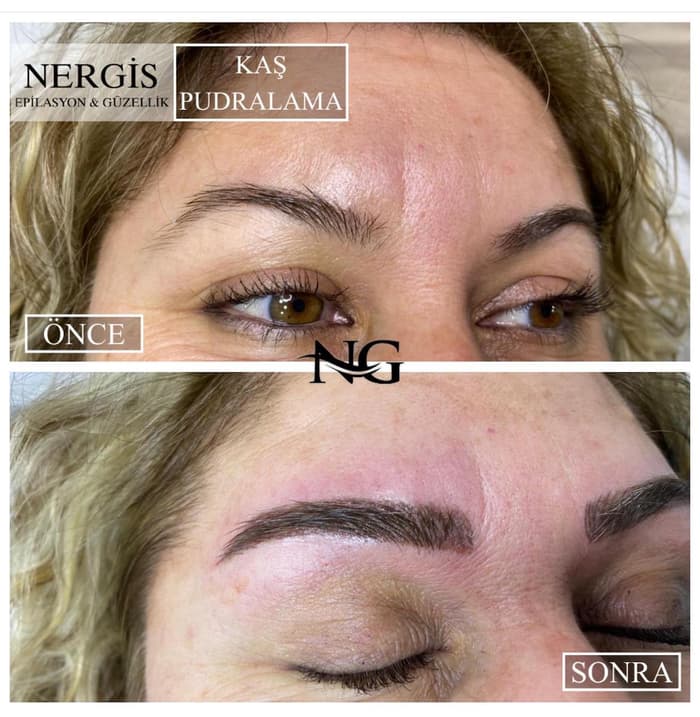 Nergis Epilasyon ve Güzellik - 1. Fotoğraf