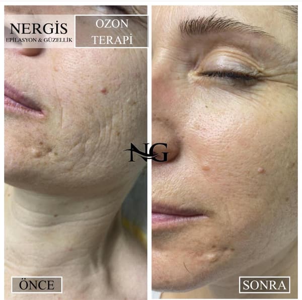 Nergis Epilasyon ve Güzellik - 5. Fotoğraf Nergis Epilasyon ve Güzellik - 5. Fotoğraf