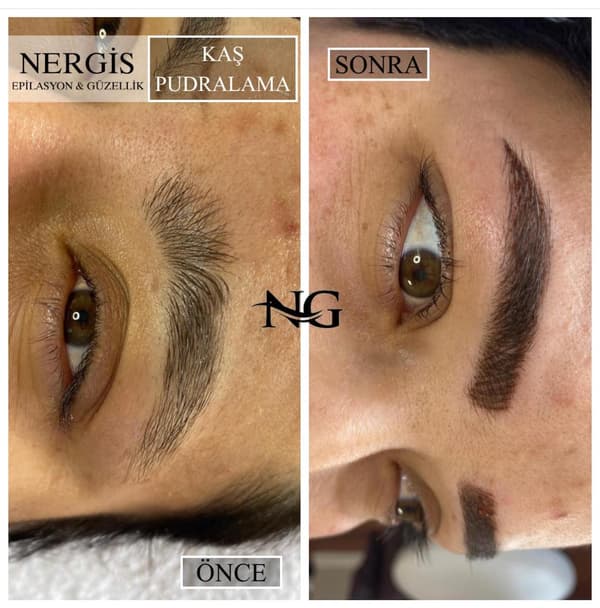 Nergis Epilasyon ve Güzellik - 7. Fotoğraf Nergis Epilasyon ve Güzellik - 7. Fotoğraf