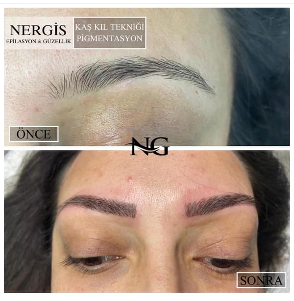 Nergis Epilasyon ve Güzellik - 15. Fotoğraf