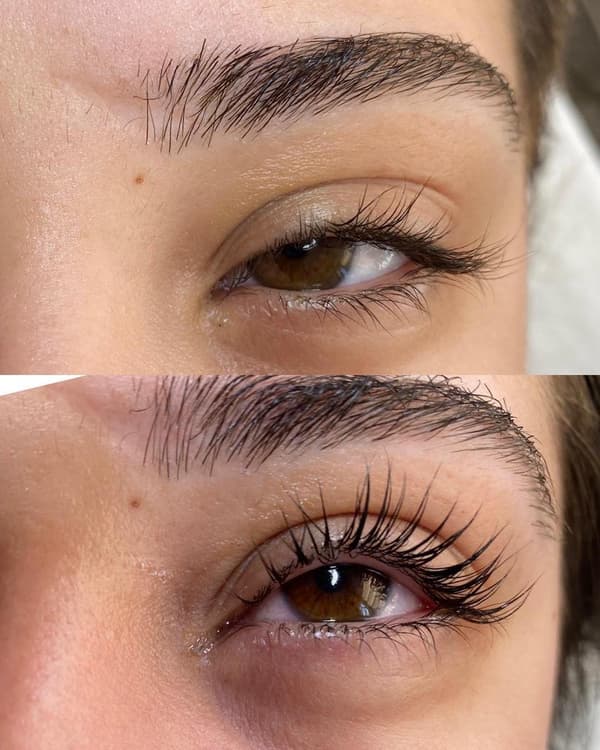 Nergis Epilasyon ve Güzellik - 16. Fotoğraf Nergis Epilasyon ve Güzellik - 16. Fotoğraf