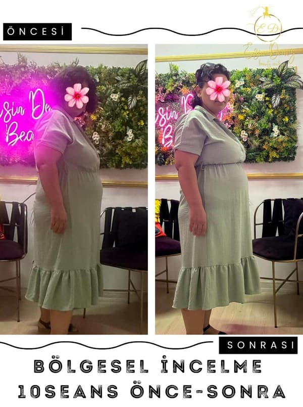 Esin Deniz Beauty  - 10. Fotoğraf