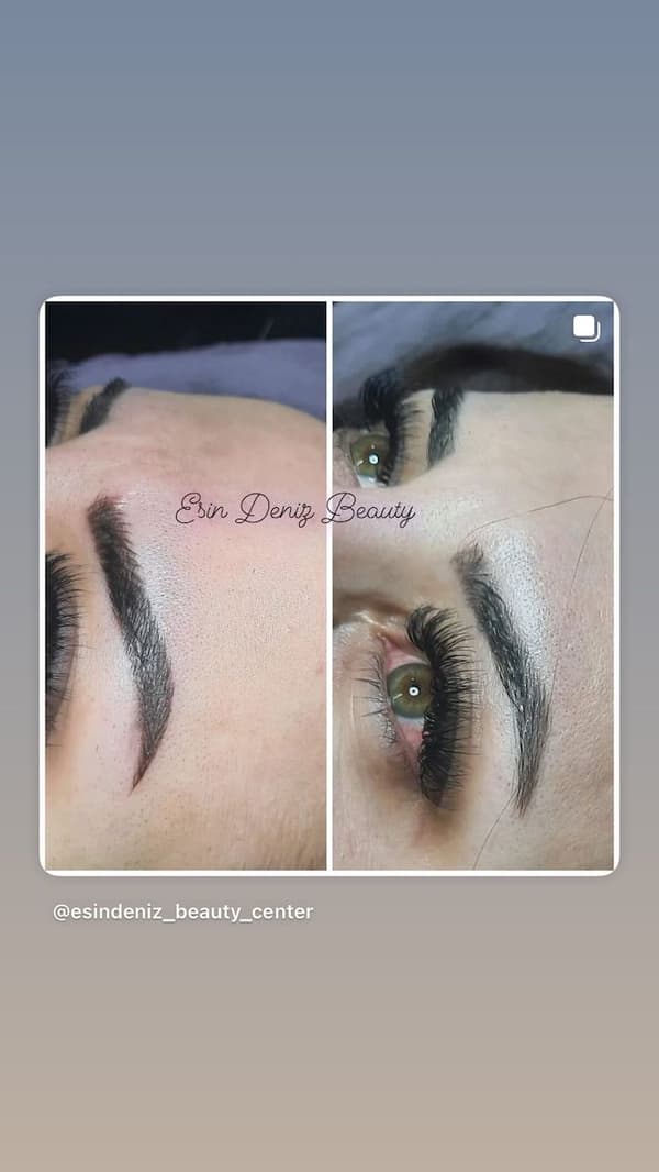 Esin Deniz Beauty - 14. Fotoğraf Esin Deniz Beauty - 14. Fotoğraf