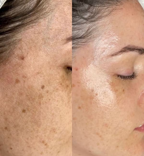 Rukiye Kuba Güzellik Salonu  - 6. Fotoğraf